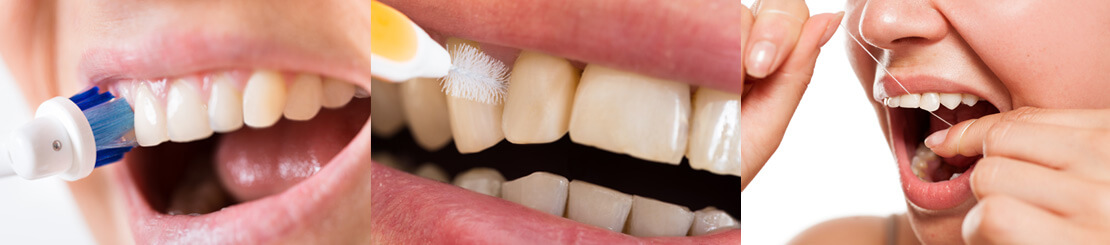 oral-hygiene-regimen1