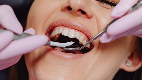 Periodontal Health